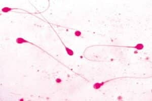 Slide, sperm—human, smear | flinn scientific