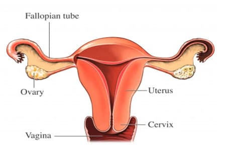 Tubal abnormalities - causes of infertility - plano fertility centerअंडवाहिनी या फैलोपियन ट्यूब (fallopian tube)