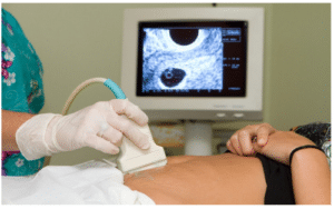 पराध्वनि चित्रण/ अल्ट्रासोनोग्राफी (ultrasonography)