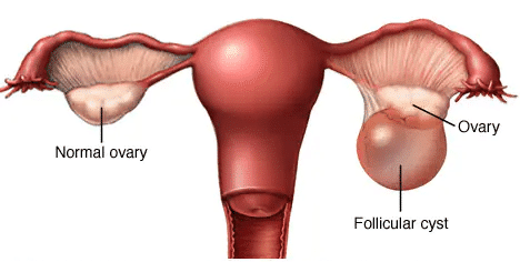 अंडाशय (ovary)